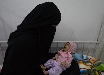 MORRENDO DE FOME NO IÊMEN